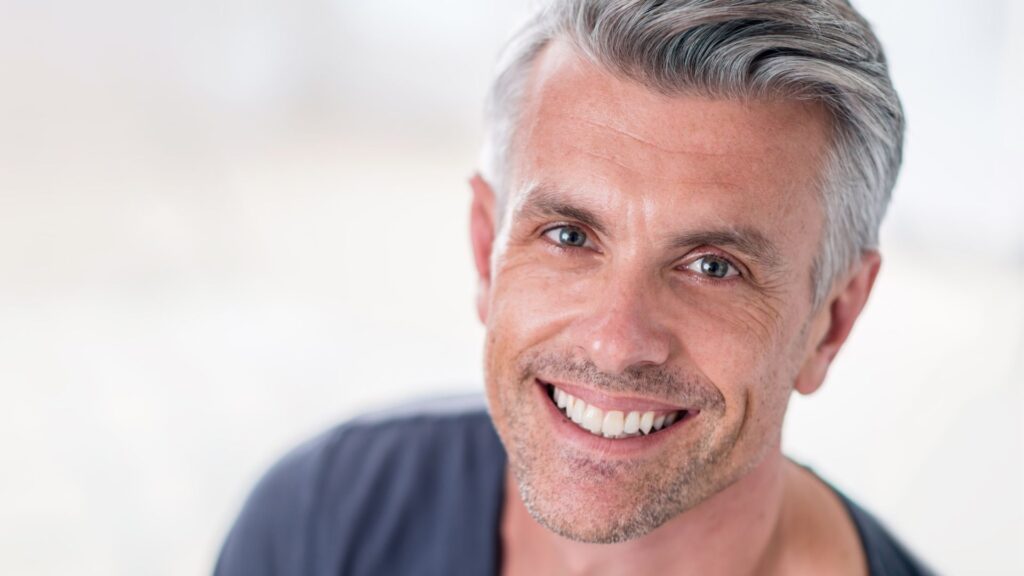 Smile design result at Hollywood Perfect Smile