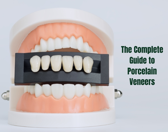 The Complete Guide to Porcelain Veneers: Everything You Need to Know