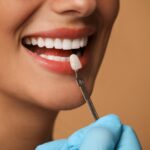 Proceso paso a paso de colocación de carillas dentales en Hollywood, Florida mostrando diseño y aplicación en dientes frontales