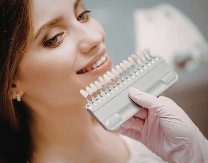 Veneers Before and After: How Smiles Are Transformed in Florida
