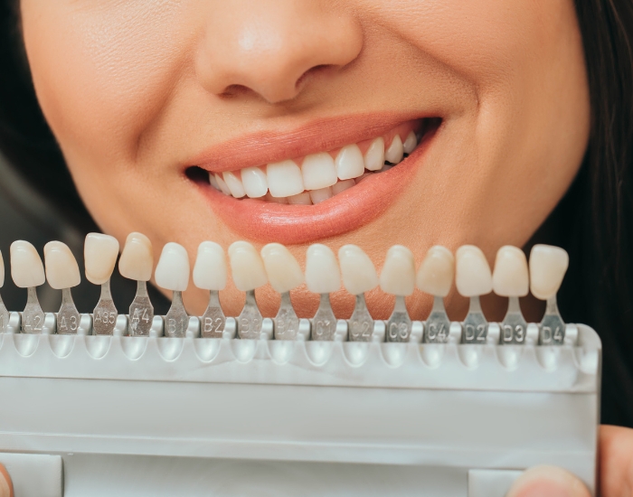How Reshaping Your Cuspid Teeth Can Transform Your Smile Naturally