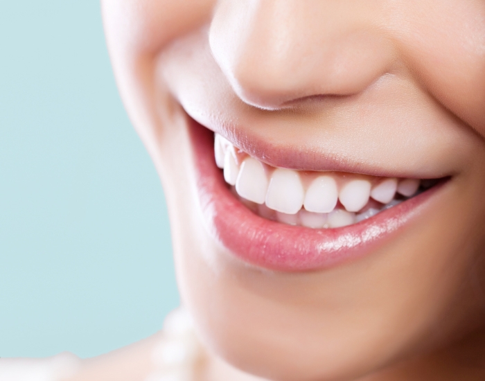 Smile makeover before and after showing improved teeth alignment, color, and overall appearance